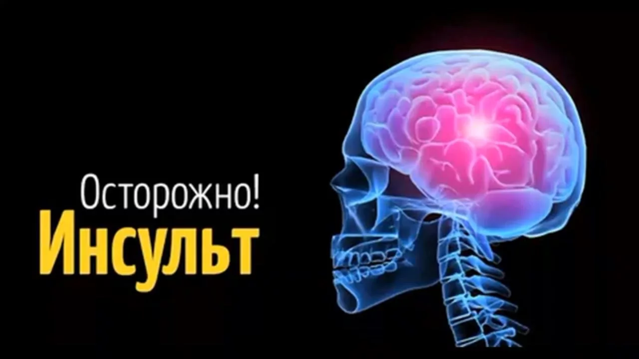 Такой разный инсульт Такой разный инсульт