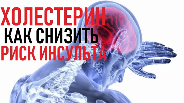 Повышенный уровень холестерина в крови и риск инсульта