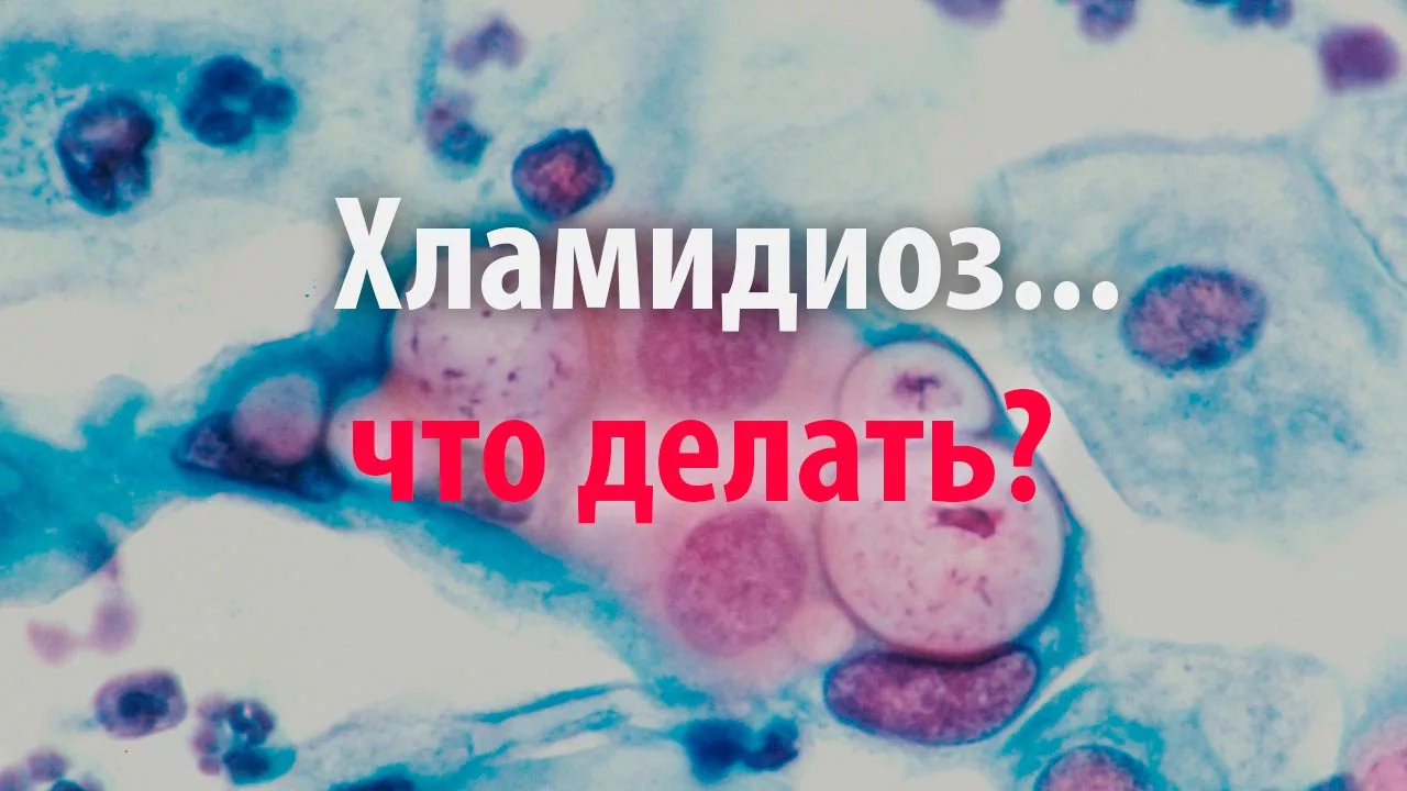 Хламидиоз 