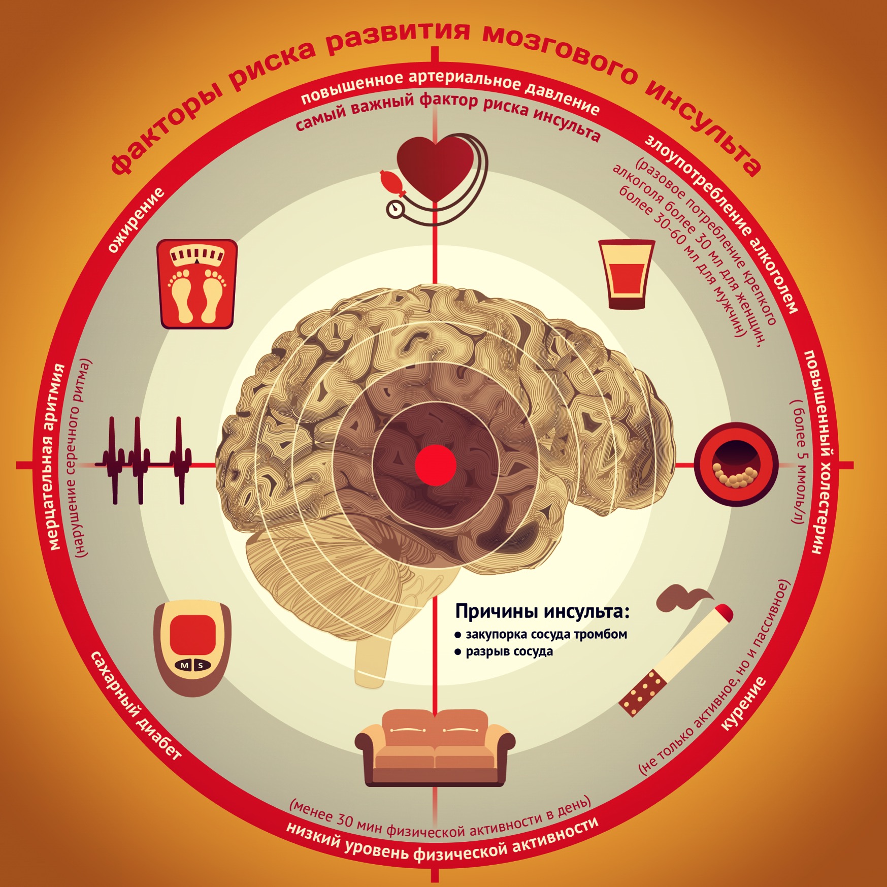Ожирение является одним из факторов риска развития инсульта Ожирение является одним из факторов риска развития инсульта